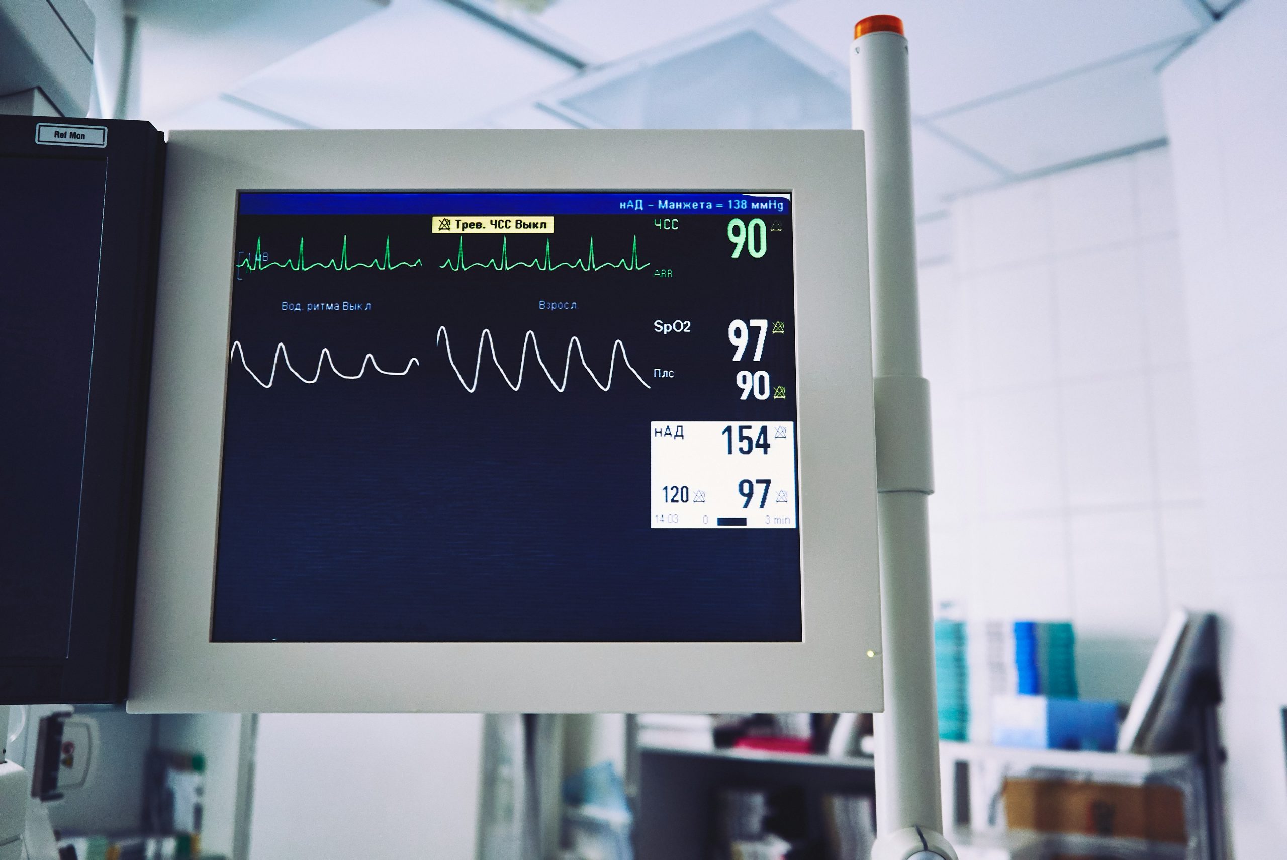 ECG monitor in a hospital